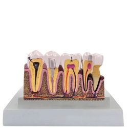   Zubný výukový anatomický model zuba s priečnym rezom a vyberateľným zubom 27614