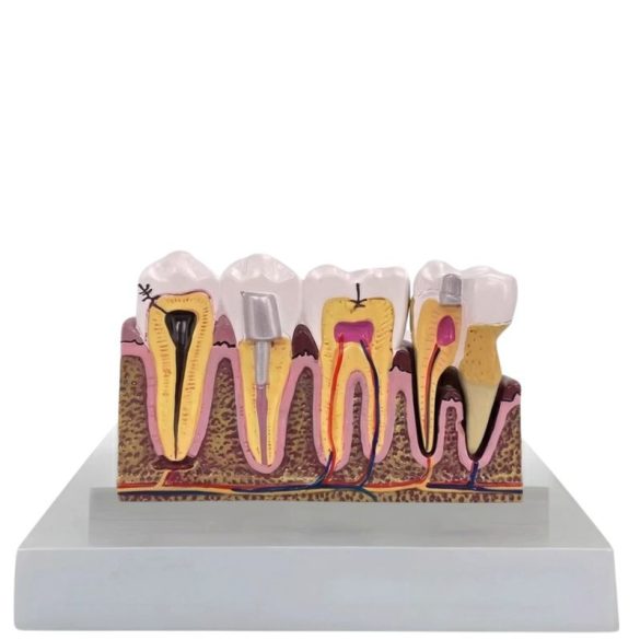 Zubný výukový anatomický model zuba s priečnym rezom a vyberateľným zubom 27614